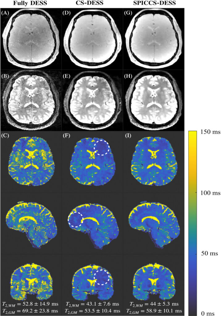 Rapid whole brain 3D T2 mapping respiratory-resolved Double-Echo Steady State (DESS) sequence with improved repeatability